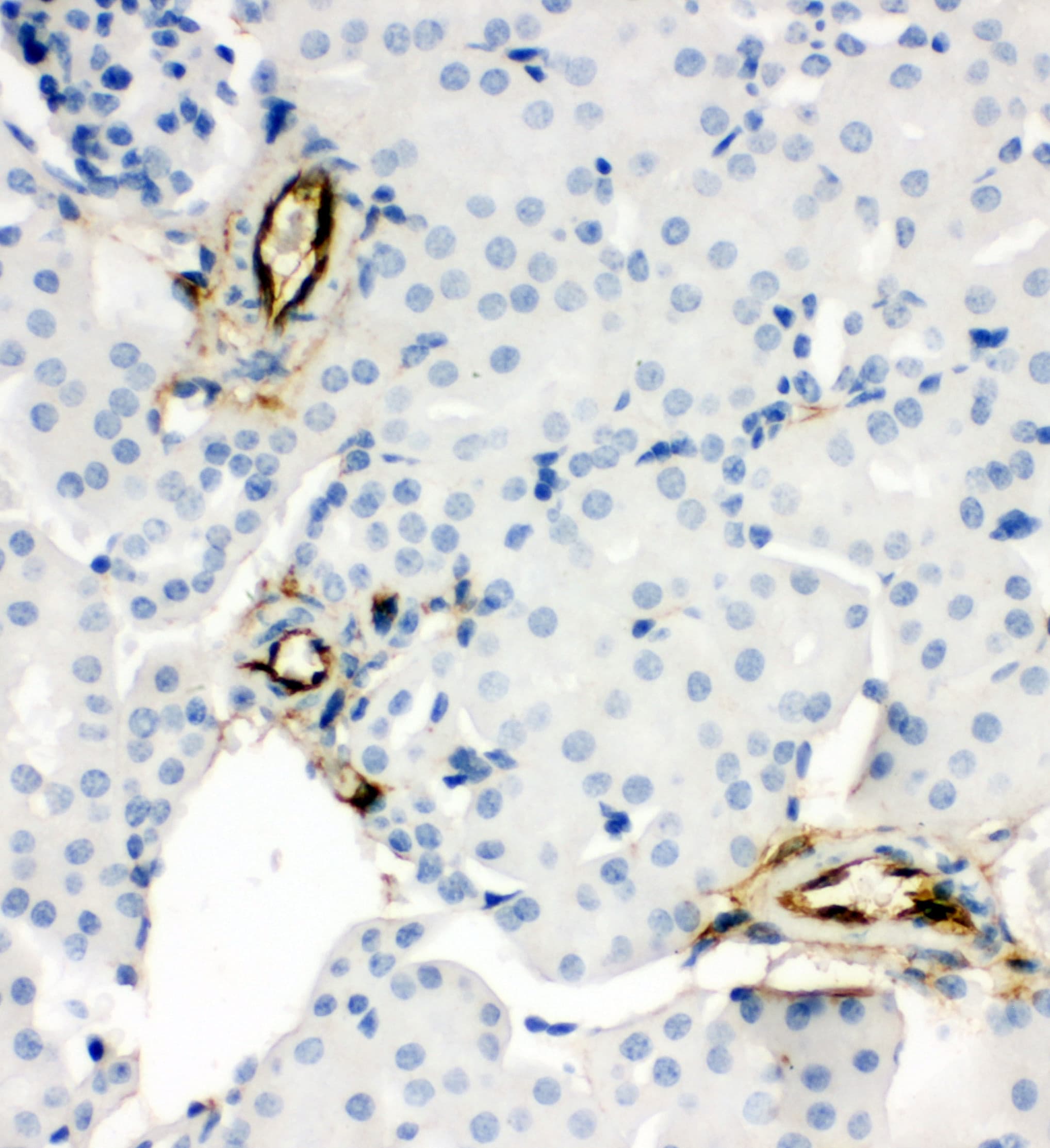 Adiponectin Antibody (aa19-244)