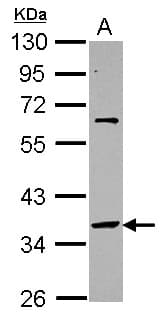 SNAP45 / SNAPC2 Antibody