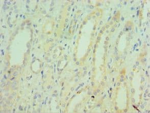 Polyclonal Rabbit anti-Human TNXB / Tenascin XB Antibody (aa3933-4242, IHC)