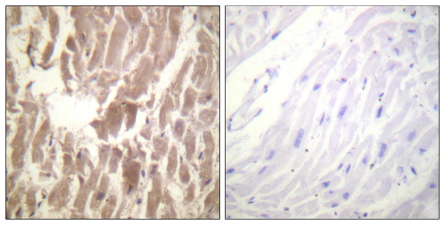 TNNI3 / Cardiac Troponin I Antibody (phospho-Ser43)