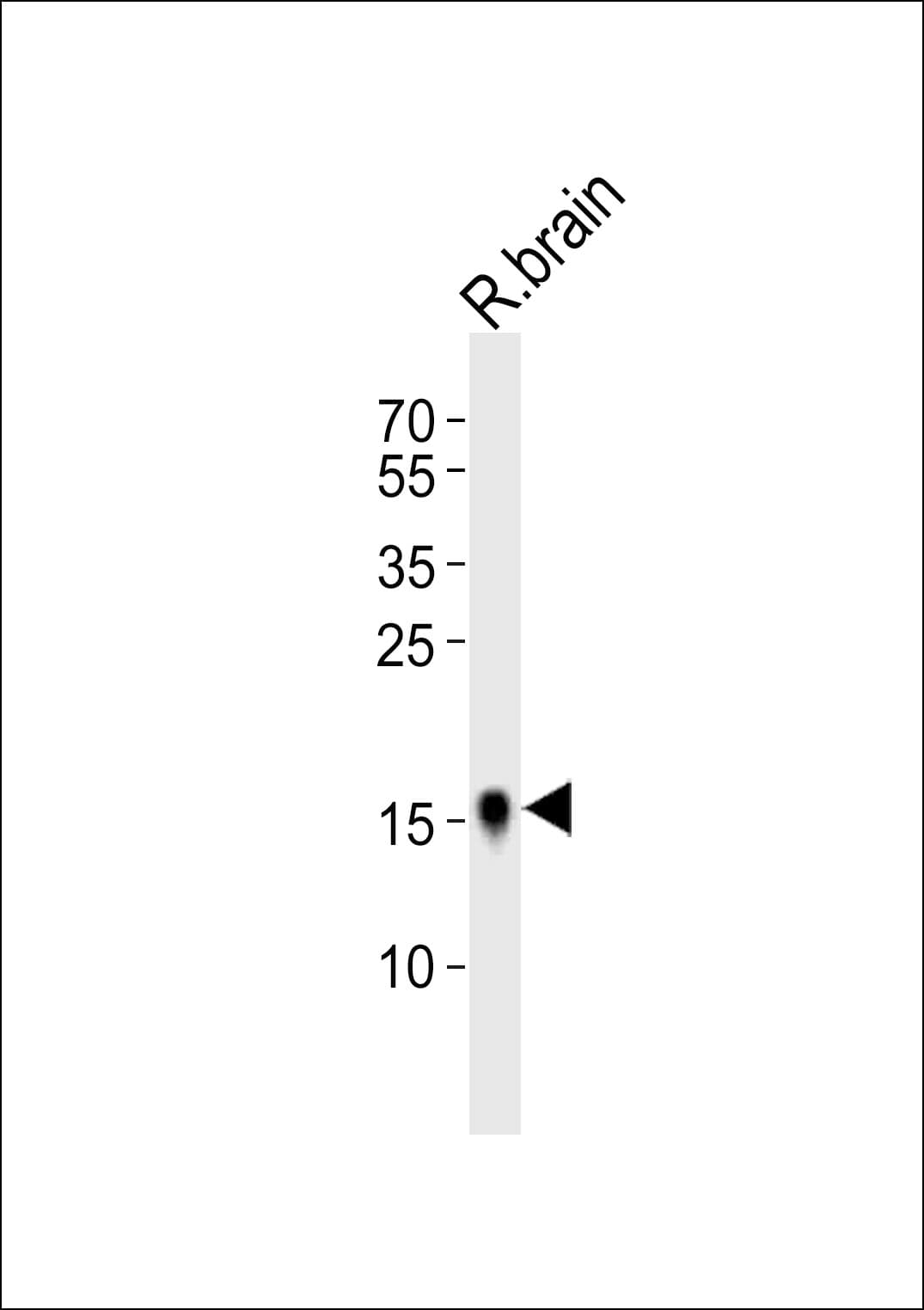Polyclonal Rabbit anti-Human FXYD1 / Phospholemman Antibody (aa69-101, WB)