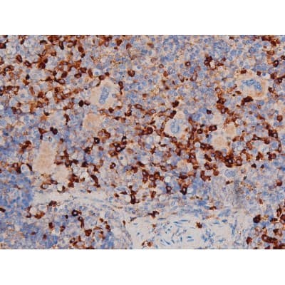 CDC25A Antibody (phospho-Ser178)