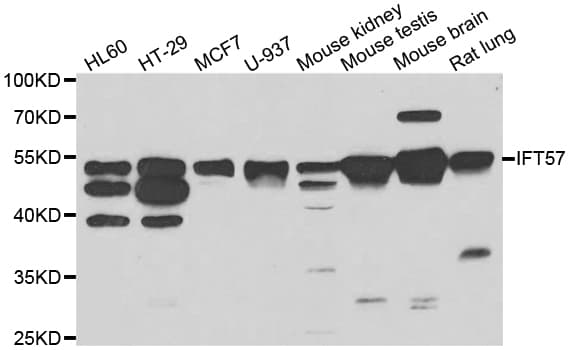 IFT57 / HIPPI Antibody