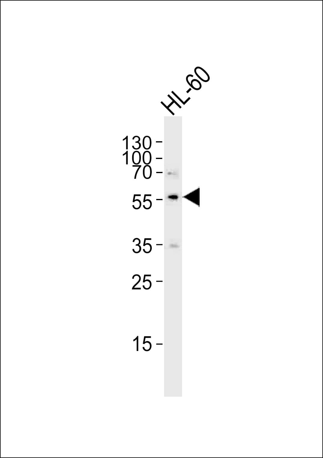 IHC-plus™ SLC29A1 / ENT1 Antibody (aa234-263)