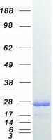Human RAB7A / RAB7 Protein (Recombinant Myc-DDK (Flag))