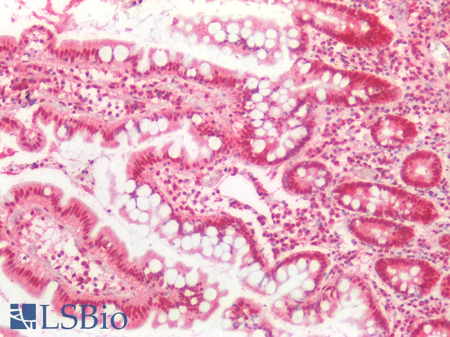 PathPlus™ TDP-43 / TARDBP Antibody (aa140-153)