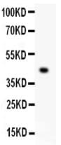 Polyclonal Rabbit anti-Human EDA / Ectodysplasin A Antibody (aa30-391, WB)