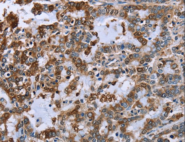 Polyclonal Rabbit anti-Human IMPDH2 Antibody (IHC, WB)
