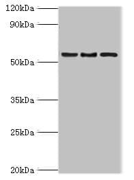 Polyclonal Rabbit anti-Human ARFGAP3 Antibody (aa217-516, IHC, WB)