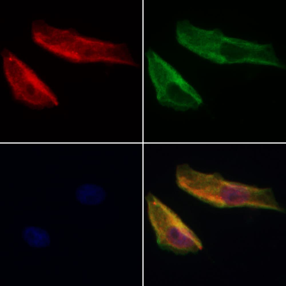 PDLIM3 Antibody