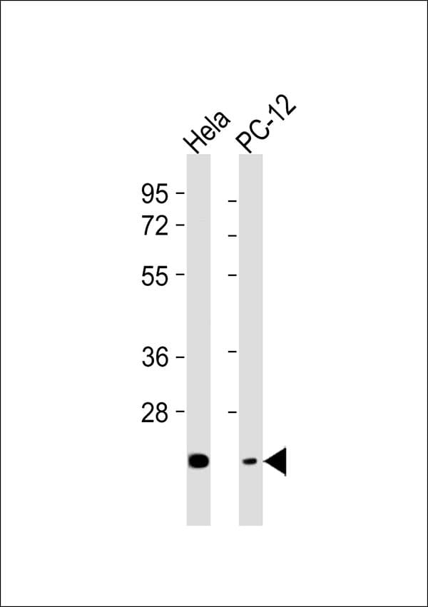 CHAC1 / MGC4504 Antibody