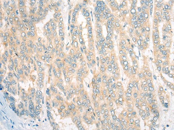 CDKAL1 Antibody