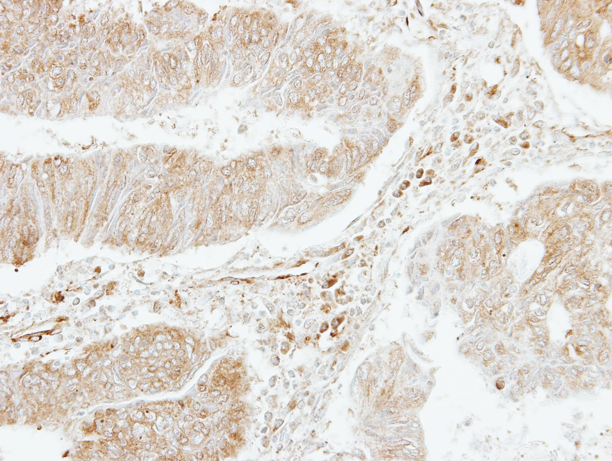 Polyclonal Rabbit anti-Human PF4V1 Antibody (aa40-104, IHC, WB)