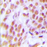 Polyclonal Rabbit anti-Human ZRANB2 / ZNF265 Antibody (Internal, IHC, IF, WB)