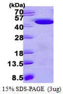 Human HAO1 Protein (Recombinant His)