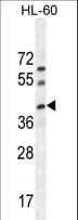Polyclonal Rabbit anti-Human C17orf59 Antibody (aa186-215, WB)