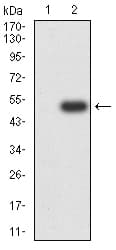 GRIK2 / GLUR6 Antibody (clone 8A1F11)
