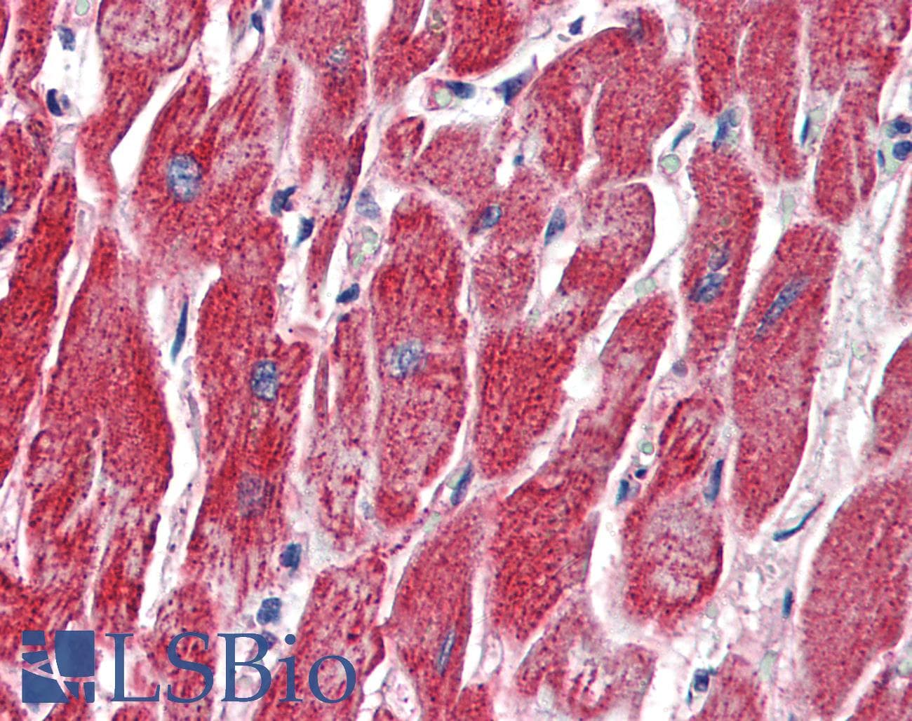 IHC-plus™ MMP14 Antibody (aa160-173)