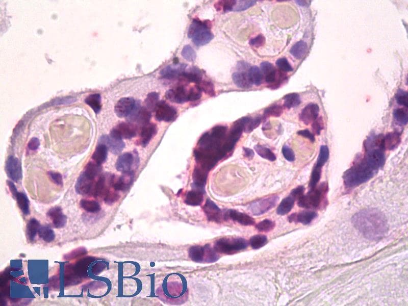 IHC-plus™ BMI1 / PCGF4 Antibody (Internal, clone EPR3745(2))