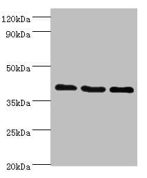 Polyclonal Rabbit anti-Human GPRC5A / RAI3 Antibody (aa258-357, IHC, WB)