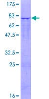 Human SLC25A25 Protein (Recombinant GST)