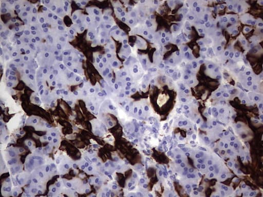 KRT19 / CK19 / Cytokeratin 19 Antibody (aa240-390, clone OTI5G7)