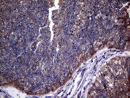 TGFBR2 Antibody (aa23-294, clone OTI3B4)
