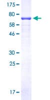 Human C9orf72 / ALSFTD Protein (Recombinant GST)