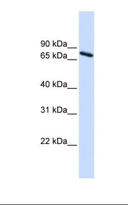 UBQLN1 / Ubiquilin Antibody (aa290-339)
