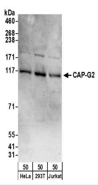 CAP-G2 / MTB Antibody (aa1100-C-term)
