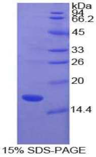 Bovine SOD1 / Cu-Zn SOD Protein (Recombinant His)