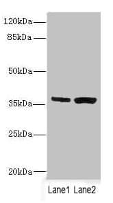 Polyclonal Rabbit anti-Human C1GALT1C1 Antibody (IHC, IF, WB)