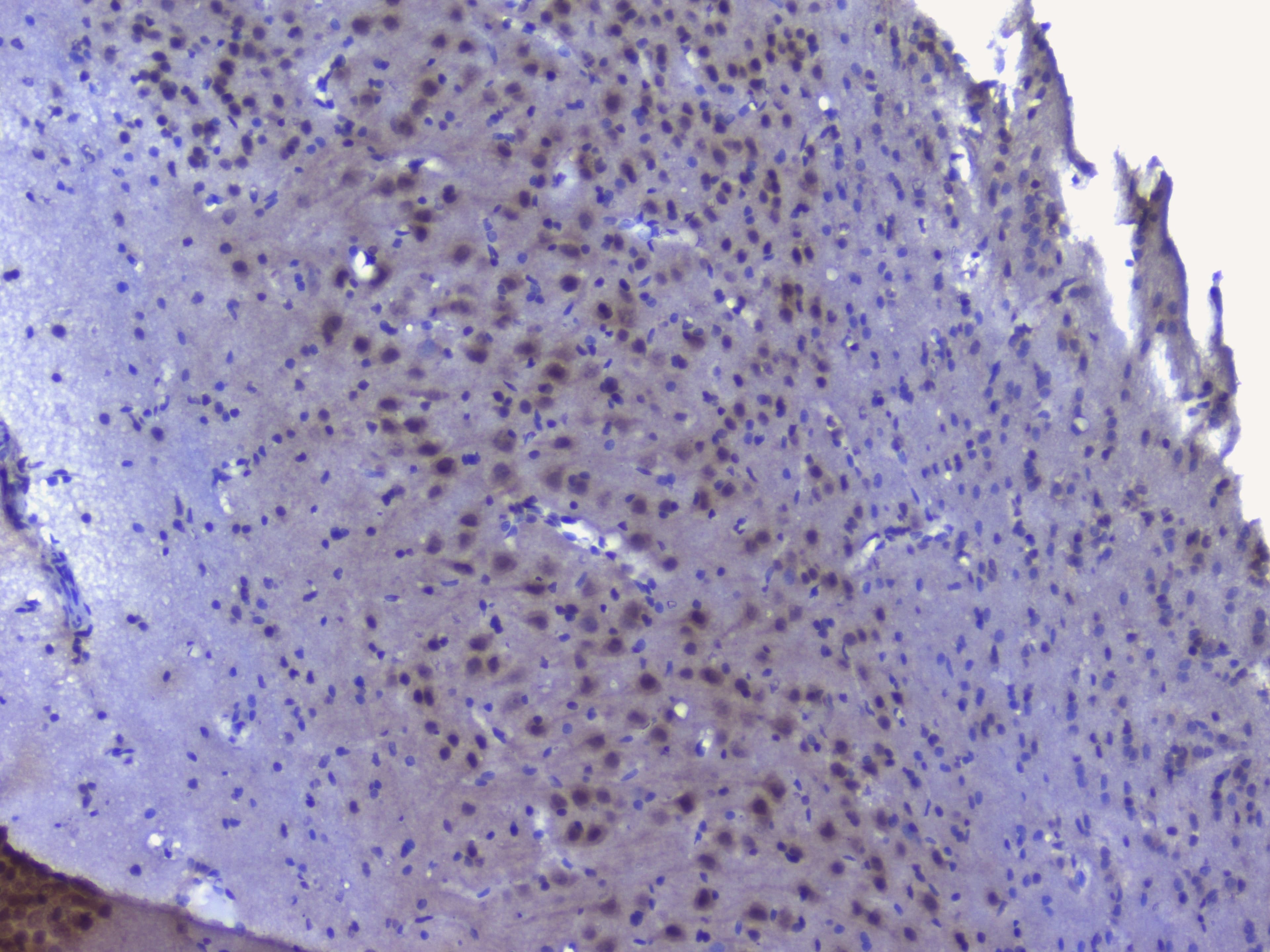 NRF1 / NRF-1 Antibody