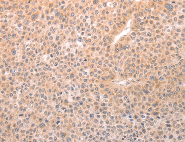 TRPC3 Antibody