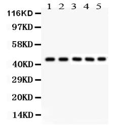 PIM1 / Pim-1 Antibody (aa373-404)