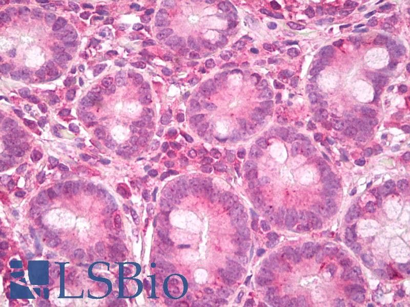 IHC-plus™ ERN1 / IRE1 Antibody