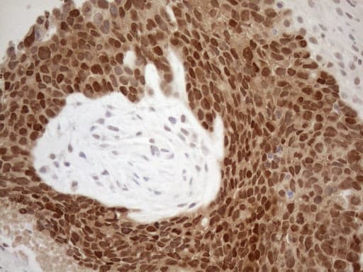 MGMT Antibody (clone OTI2E2)