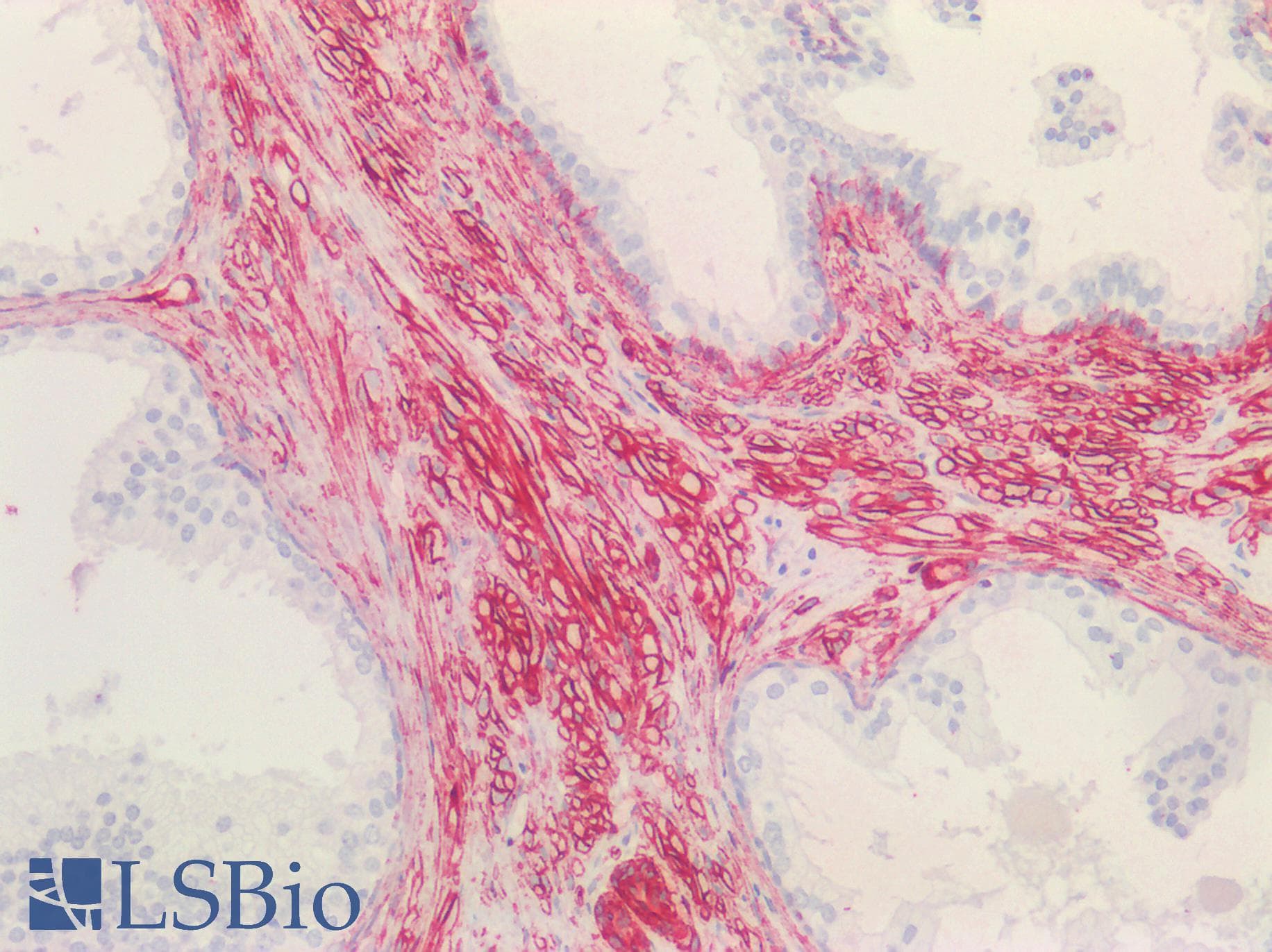 PathPlus™ Polyclonal Goat anti-Human CAV1 / Caveolin 1 Antibody (aa73-84, IHC, IF, WB)