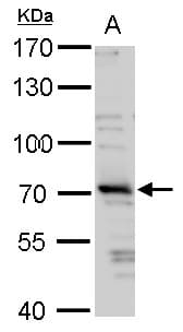 IHC-plus™ HT2A / TRIM32 Antibody (aa1-289)