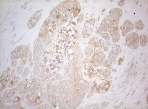 TWF1 / PTK9 Antibody (aa140-384, clone OTI5C12)