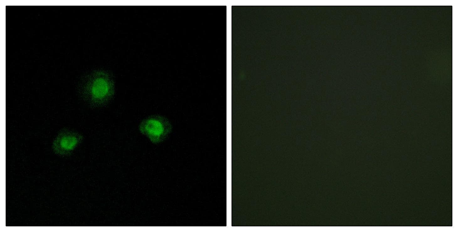 Polyclonal Rabbit anti-Human UBN1 / Ubinuclein 1 Antibody (IHC, IF)