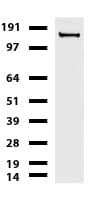 L1CAM Antibody (clone UMAB47, Carrier-free)