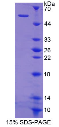 Human SHC3 / SHCC Protein (Recombinant His-GST-S)