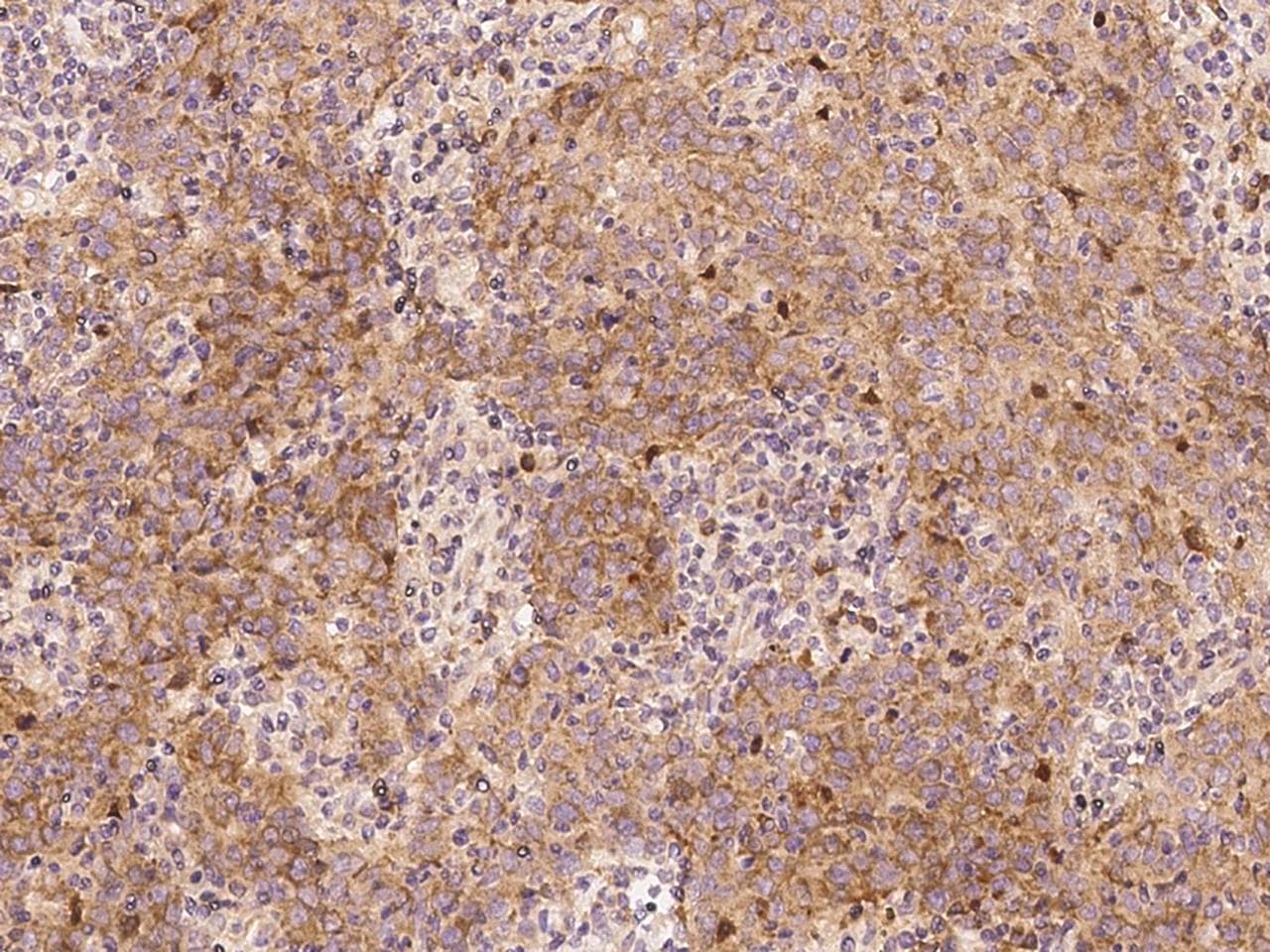 PABPC1 / PABP1 Antibody (Preservative Free)