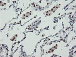 Monoclonal Mouse anti-Human TPRKB Antibody (clone OTI1E9, IHC, WB)