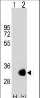GNMT Antibody (aa78-106)