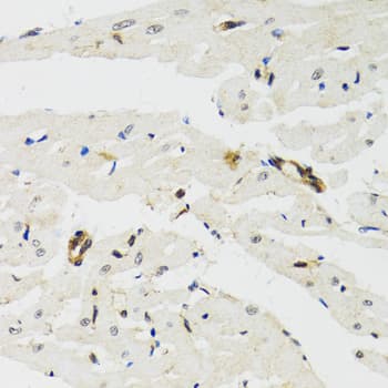 THAP1 Antibody (AP)