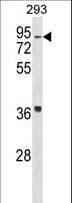 HIRIP3 Antibody (aa287-316)