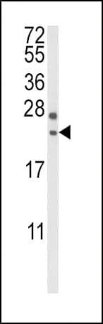 RGS4 Antibody (aa147-174)