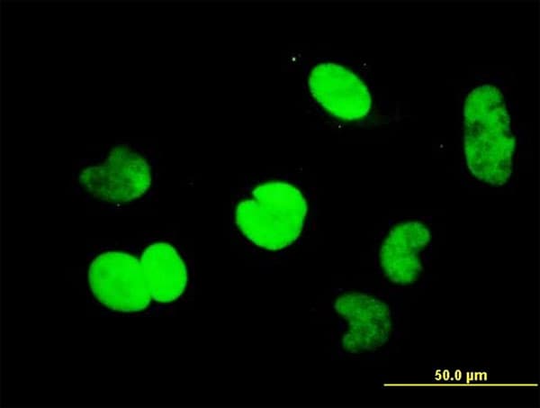 IHC-plus™ Monoclonal Mouse anti-Human CTBP1 / CTBP Antibody (clone 2G7, IHC, IF, WB)
